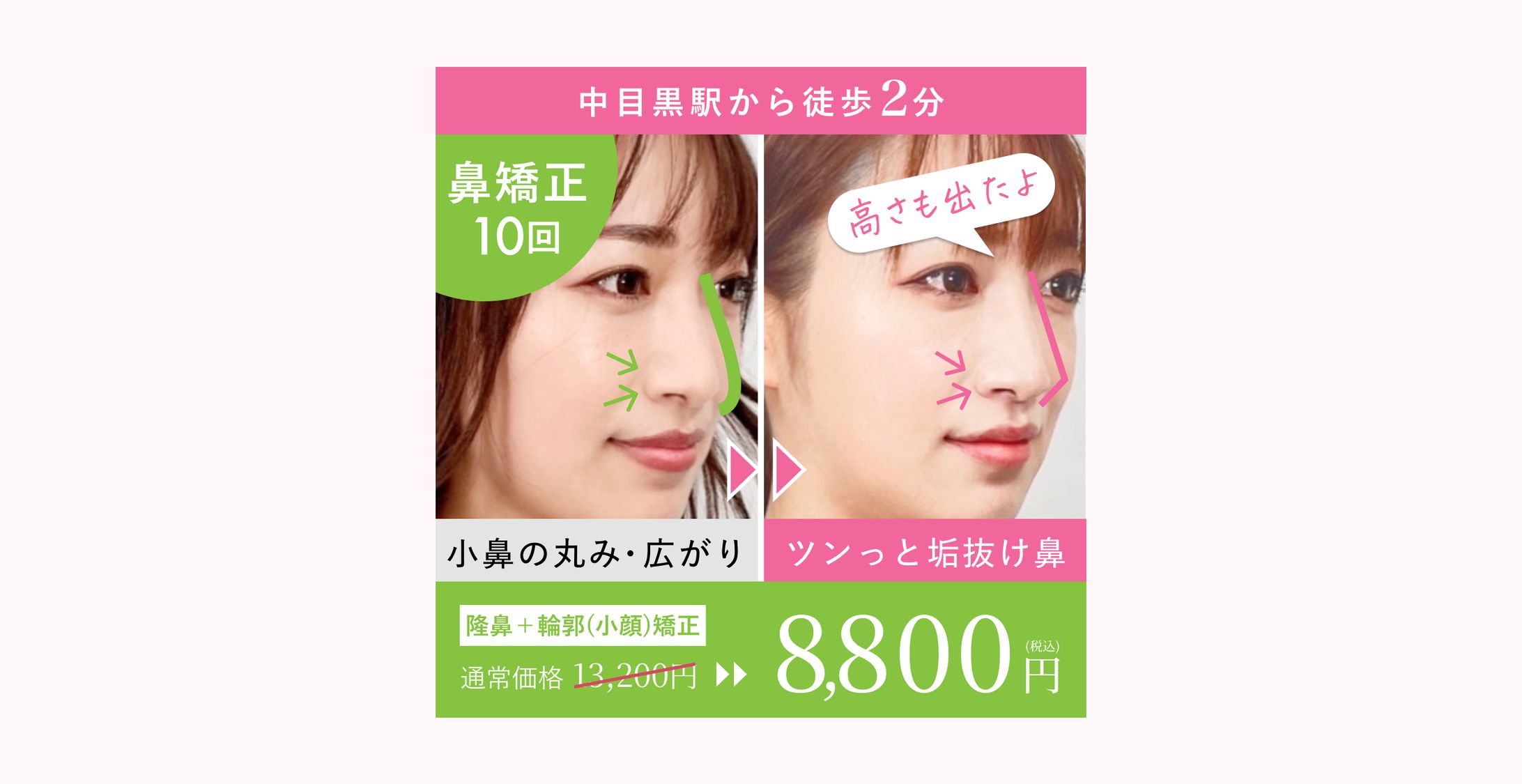 広告バナー-1