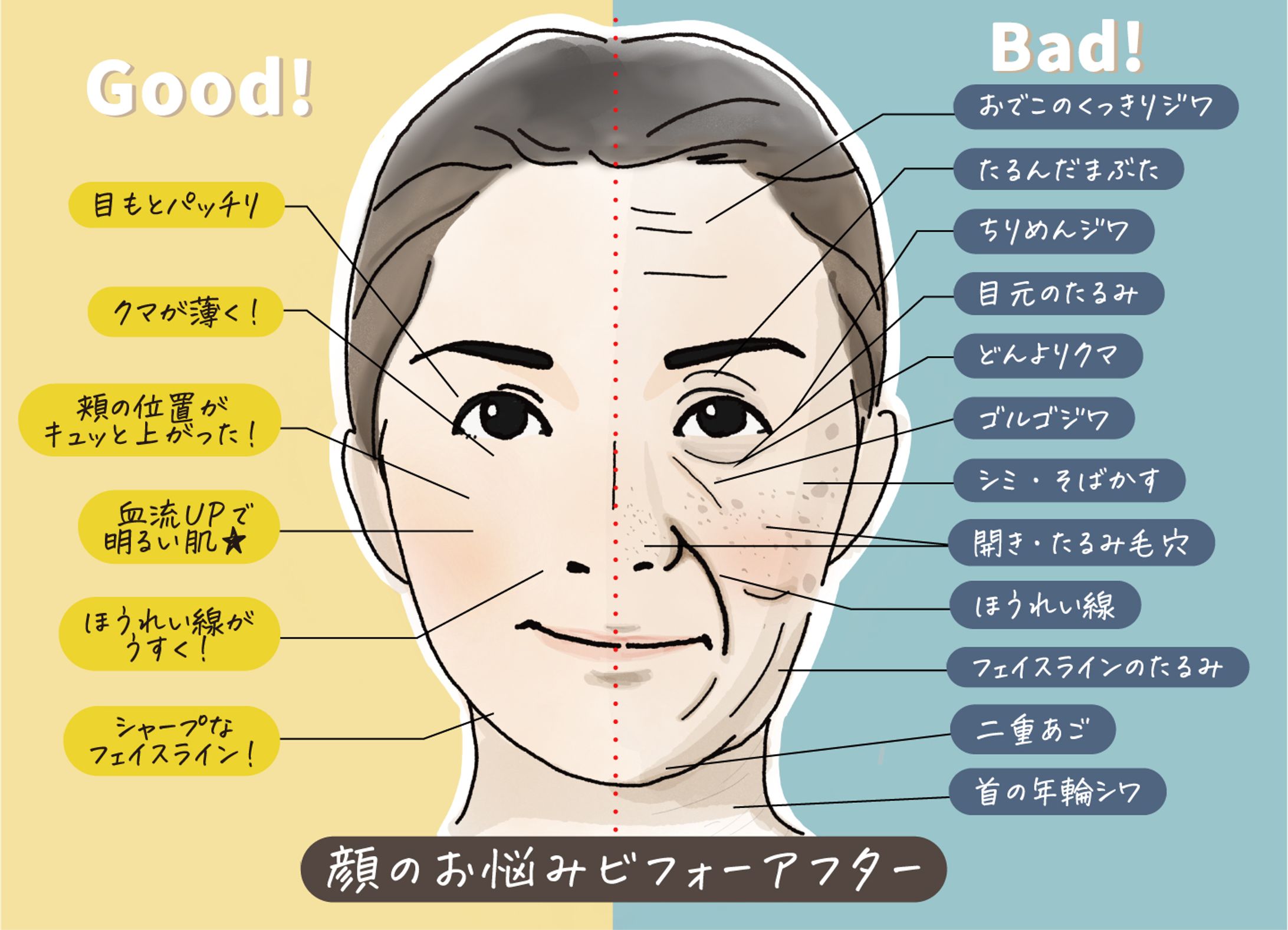 顔悩みのビフォーアフター-1