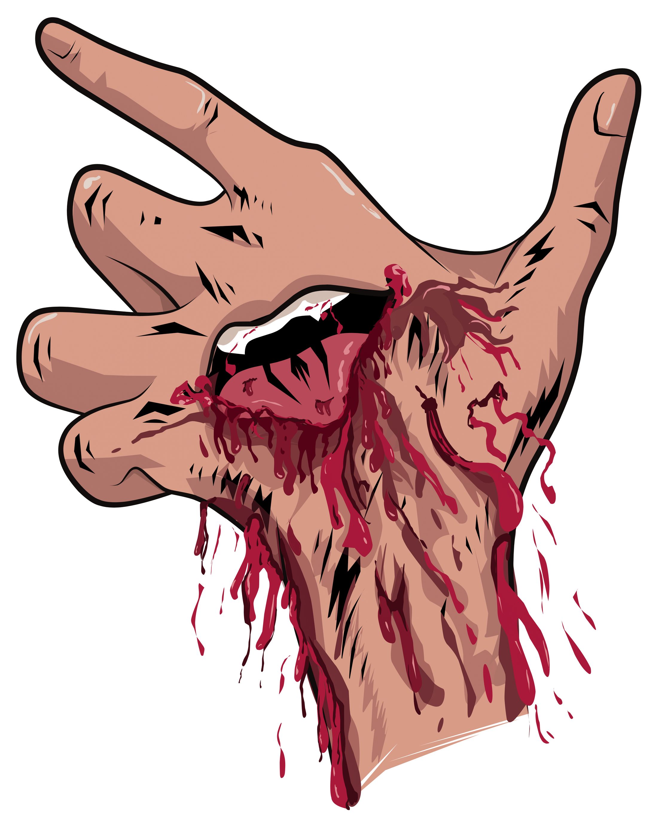 Dead Hand-1