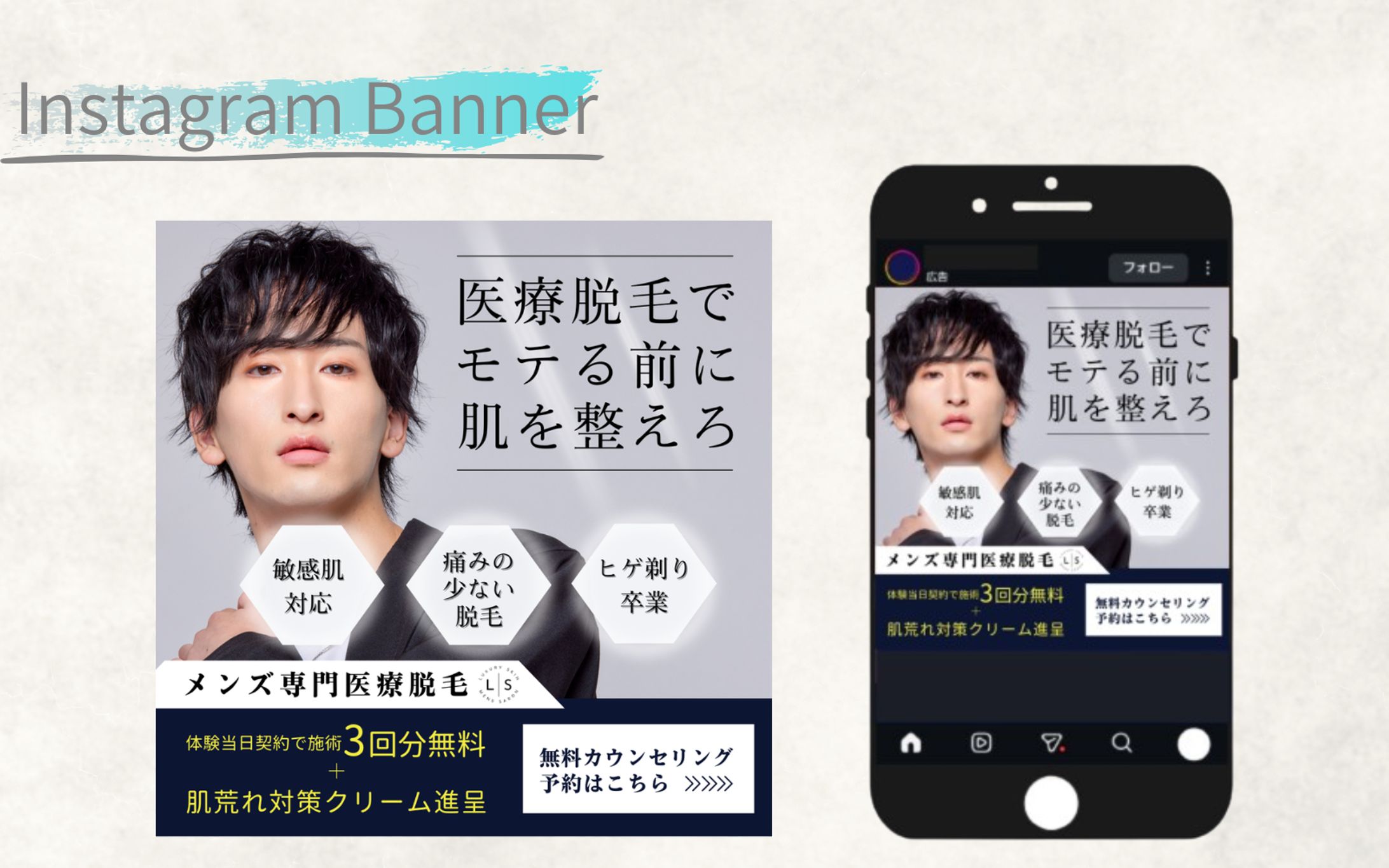 【HerTech架空案件】メンズ専門医療脱毛バナー-1