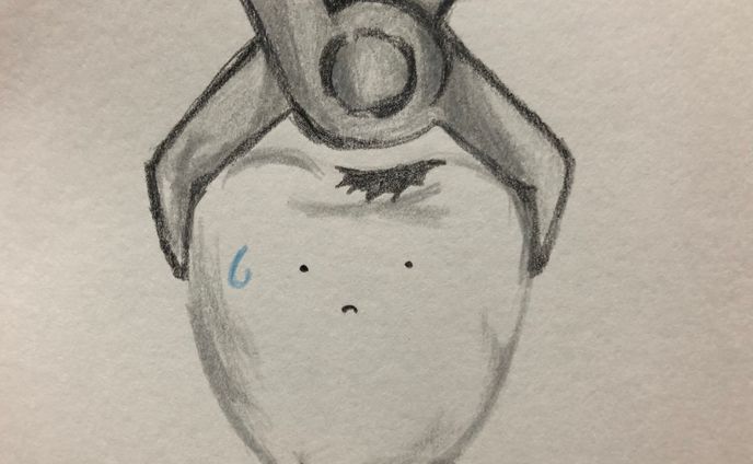 抜かれる歯