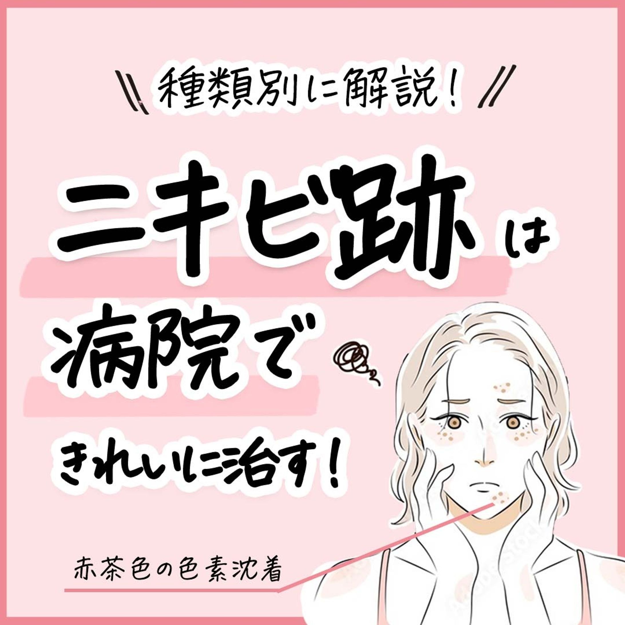 美容皮膚科のSNS投稿クリエイティブ-1