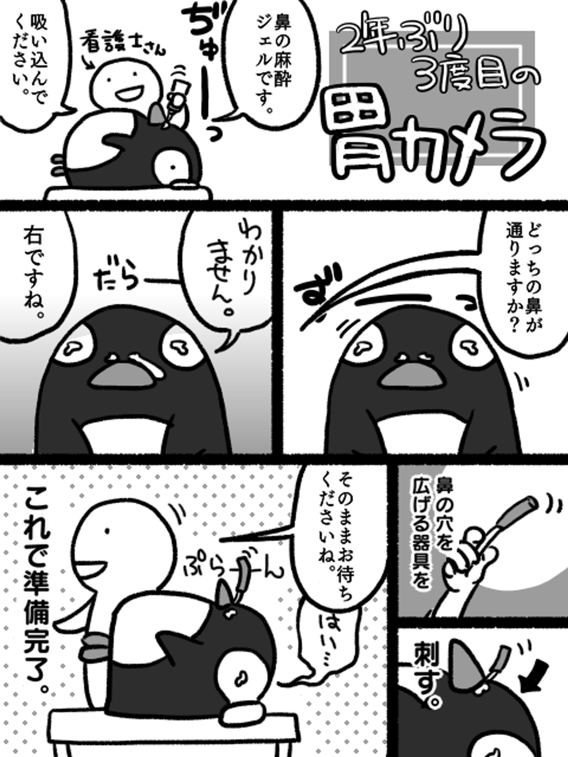 鼻から入れる胃カメラレポート-1