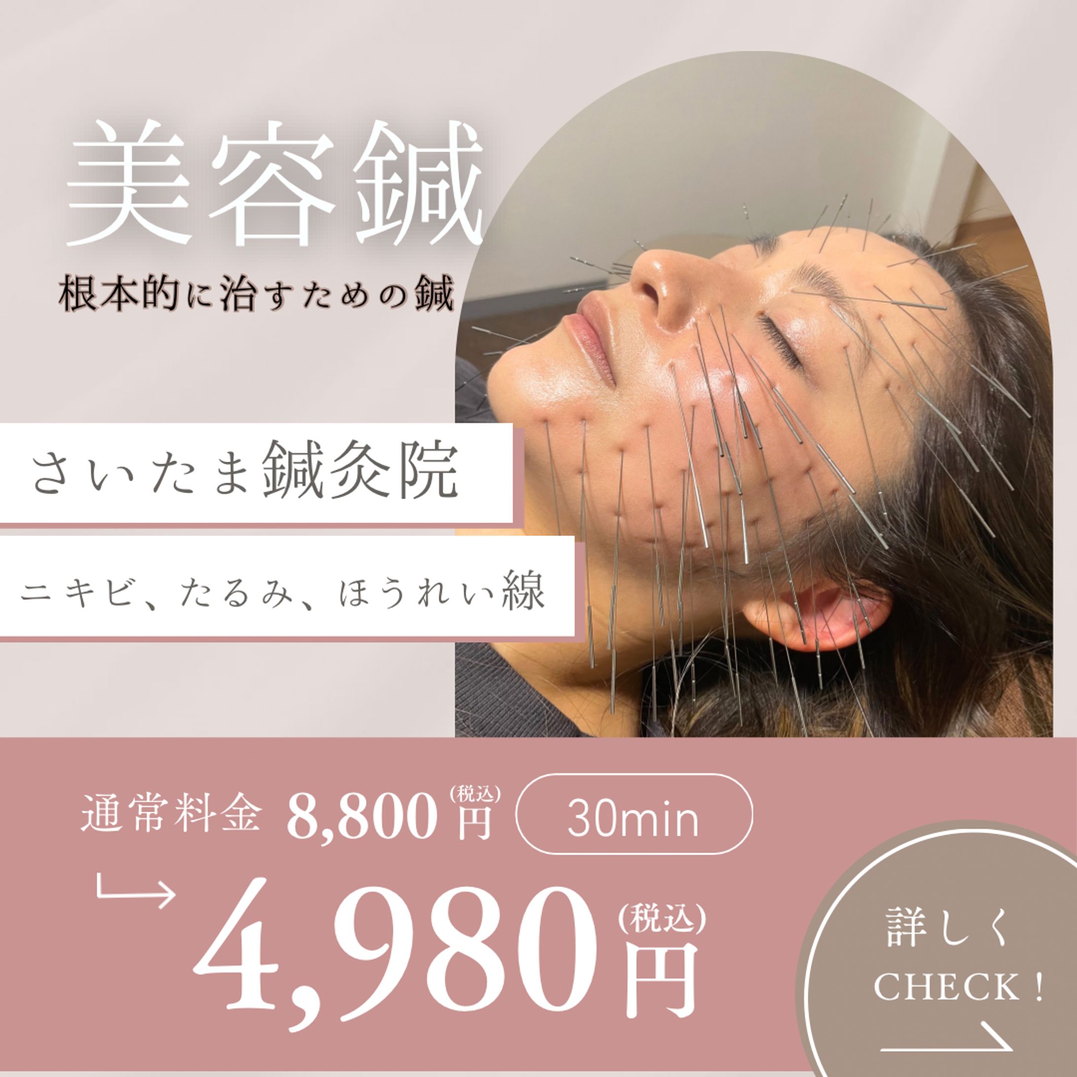 鍼灸院Instagram投稿　チラシ-1