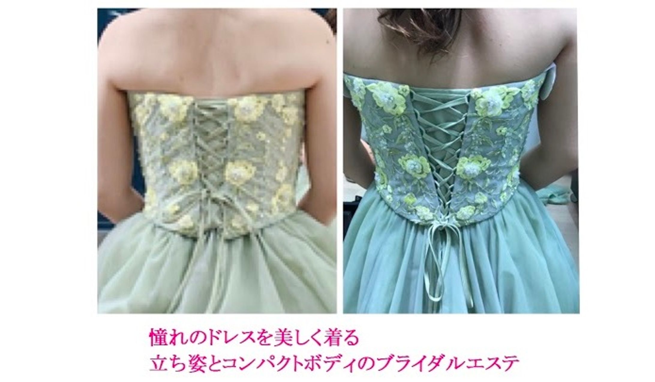 K様のブライダルエステ-1