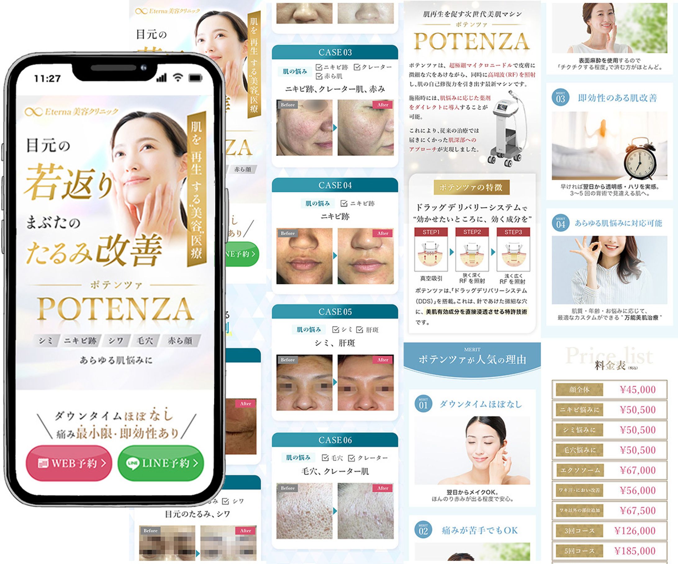 LP：ポテンツァ-1