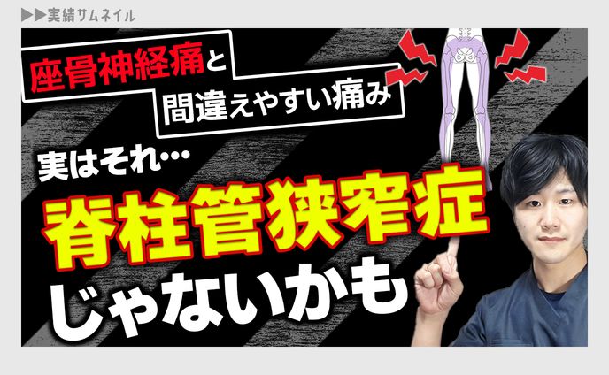 サムネイル、歴史