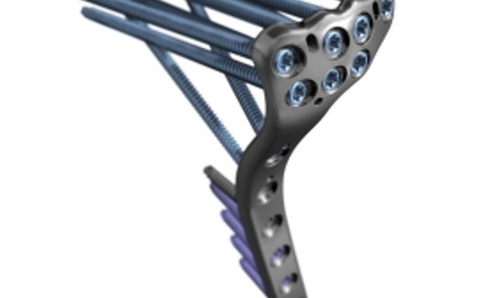 脛骨プラトー固定プレート市場分析：製品、用途、タイプ、メーカー別の現状分析、統計、業界動向2024-2030