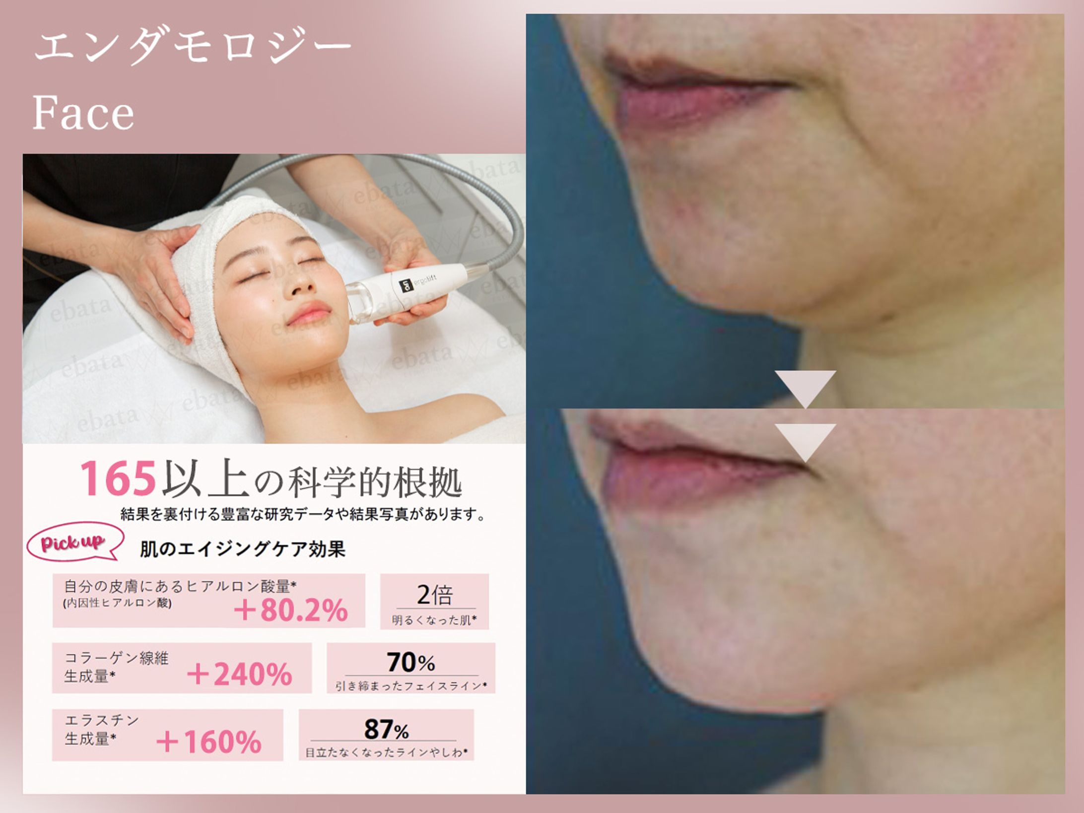 株式会社 kannonbeauty様　Hotpepper Beauty掲載画像-1