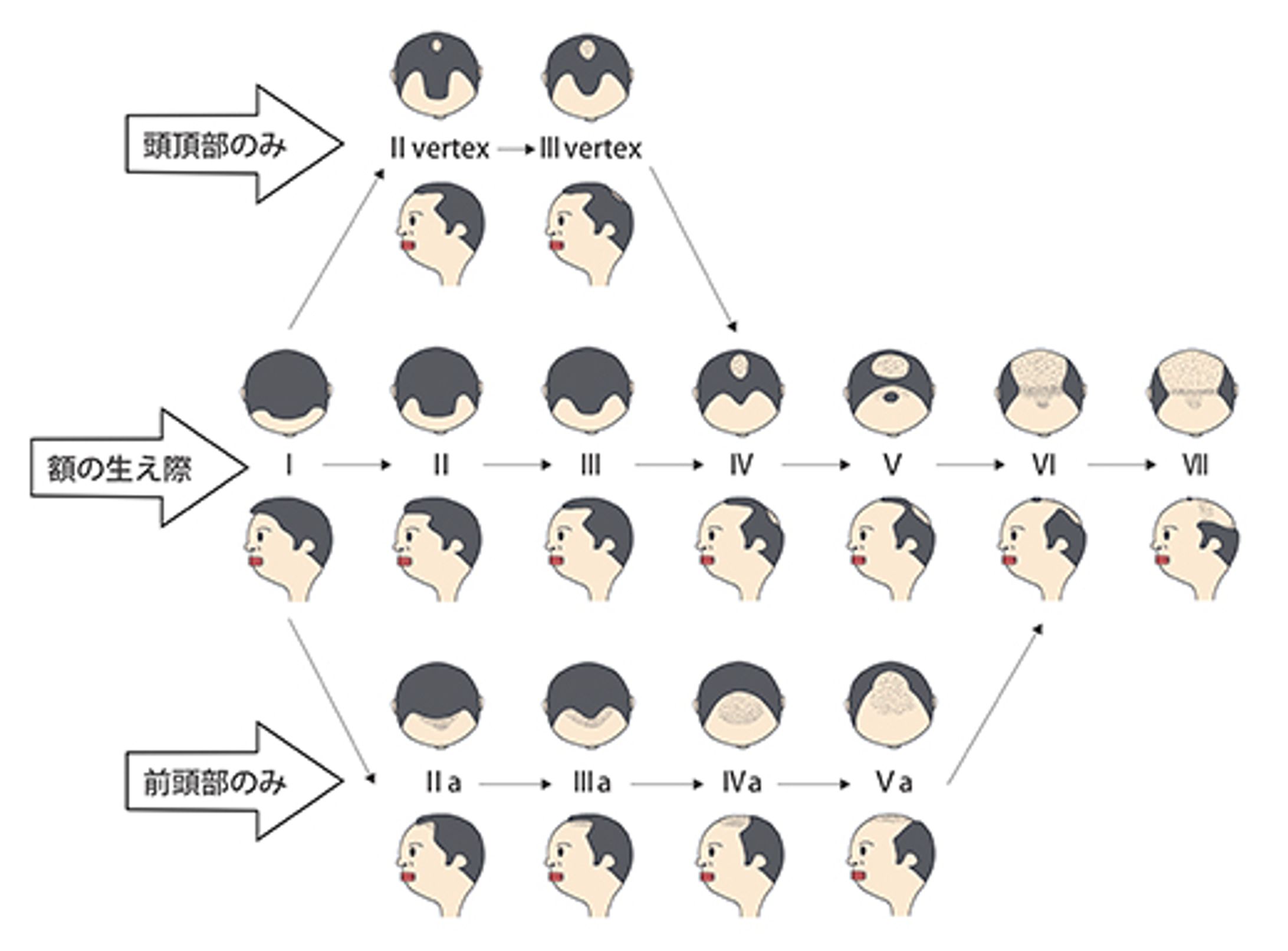 AGA説明用画像-1