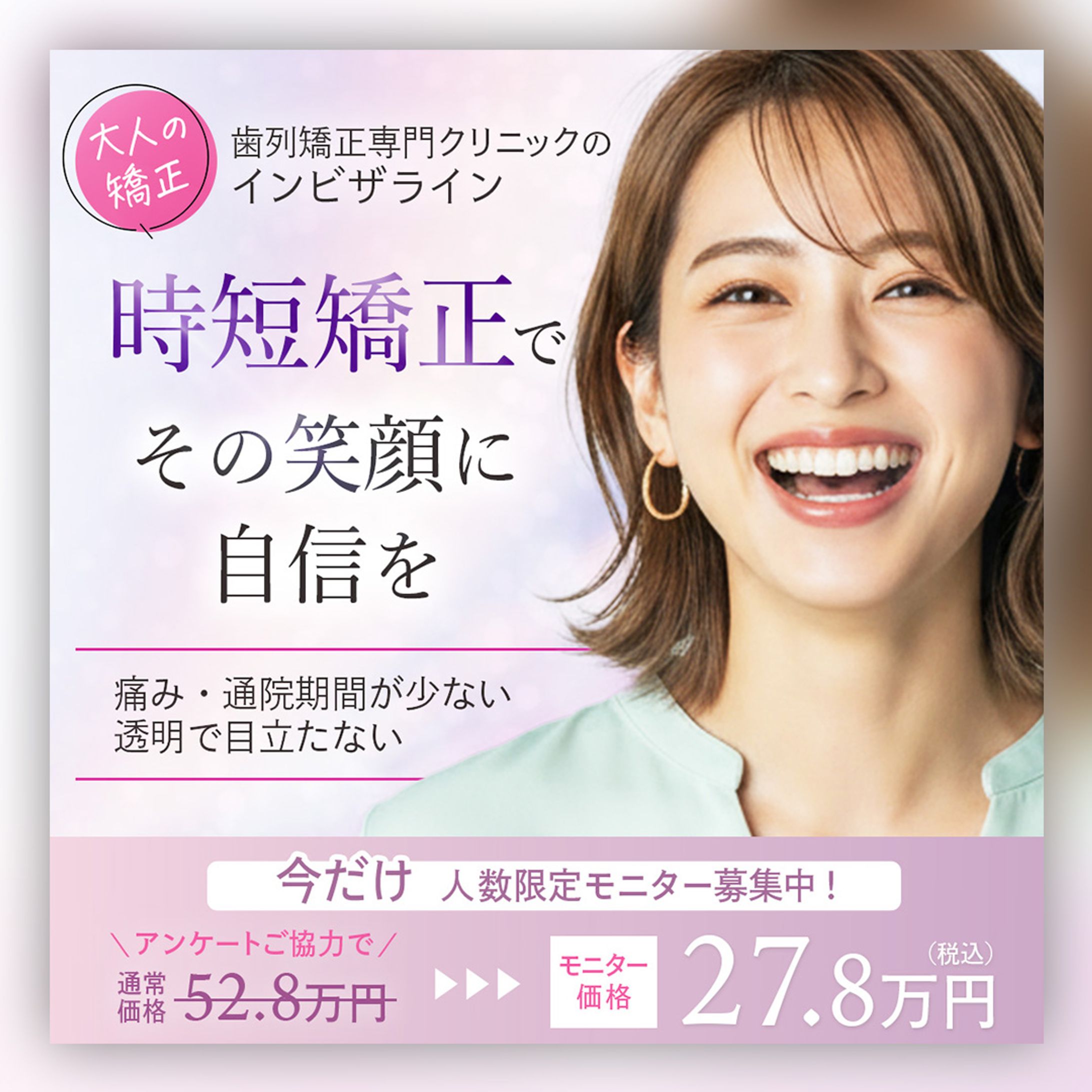 バナー｜マウスピース矯正（インビザライン）-1