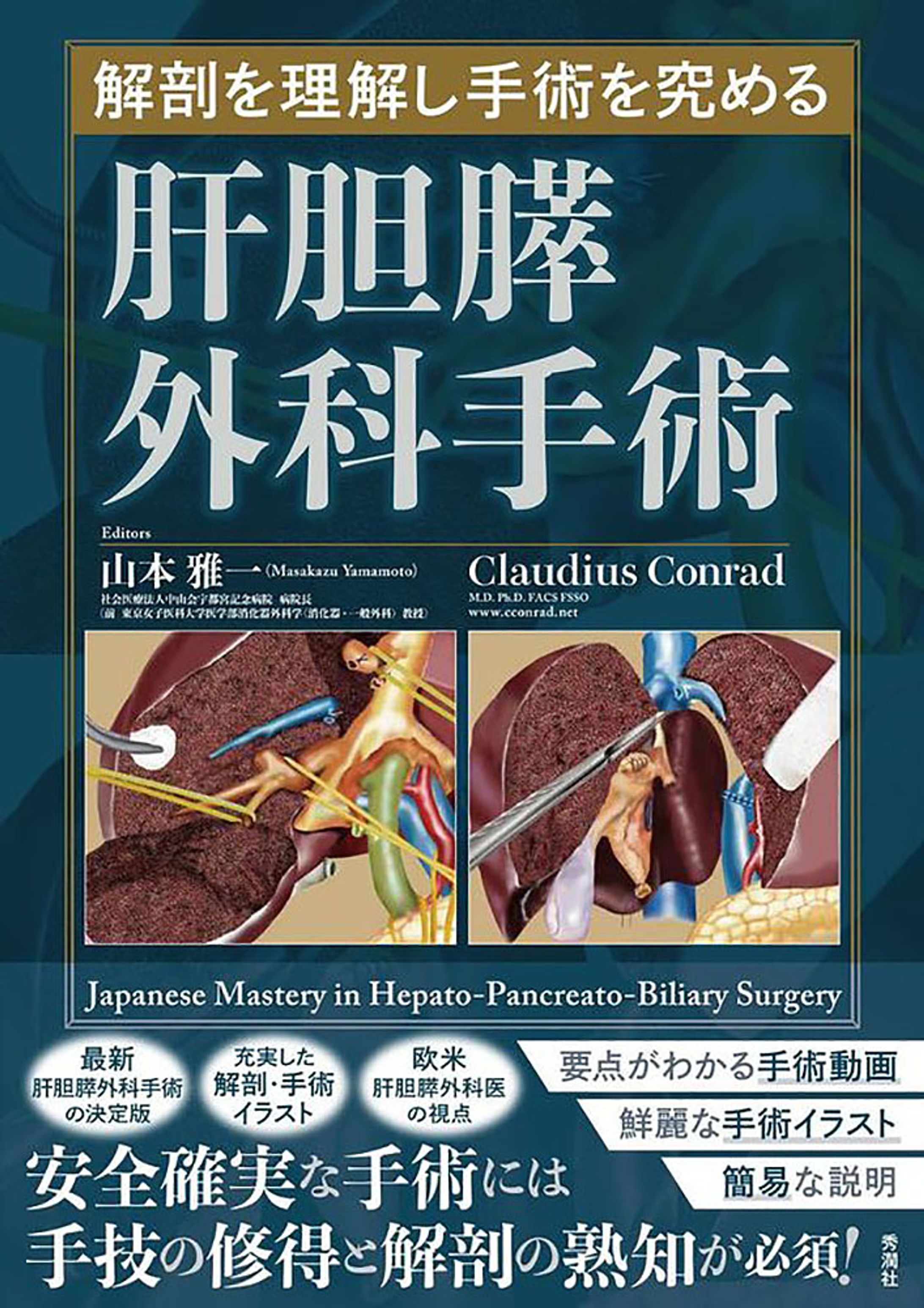 解剖を理解し手術を究める 肝胆膵外科手術-1
