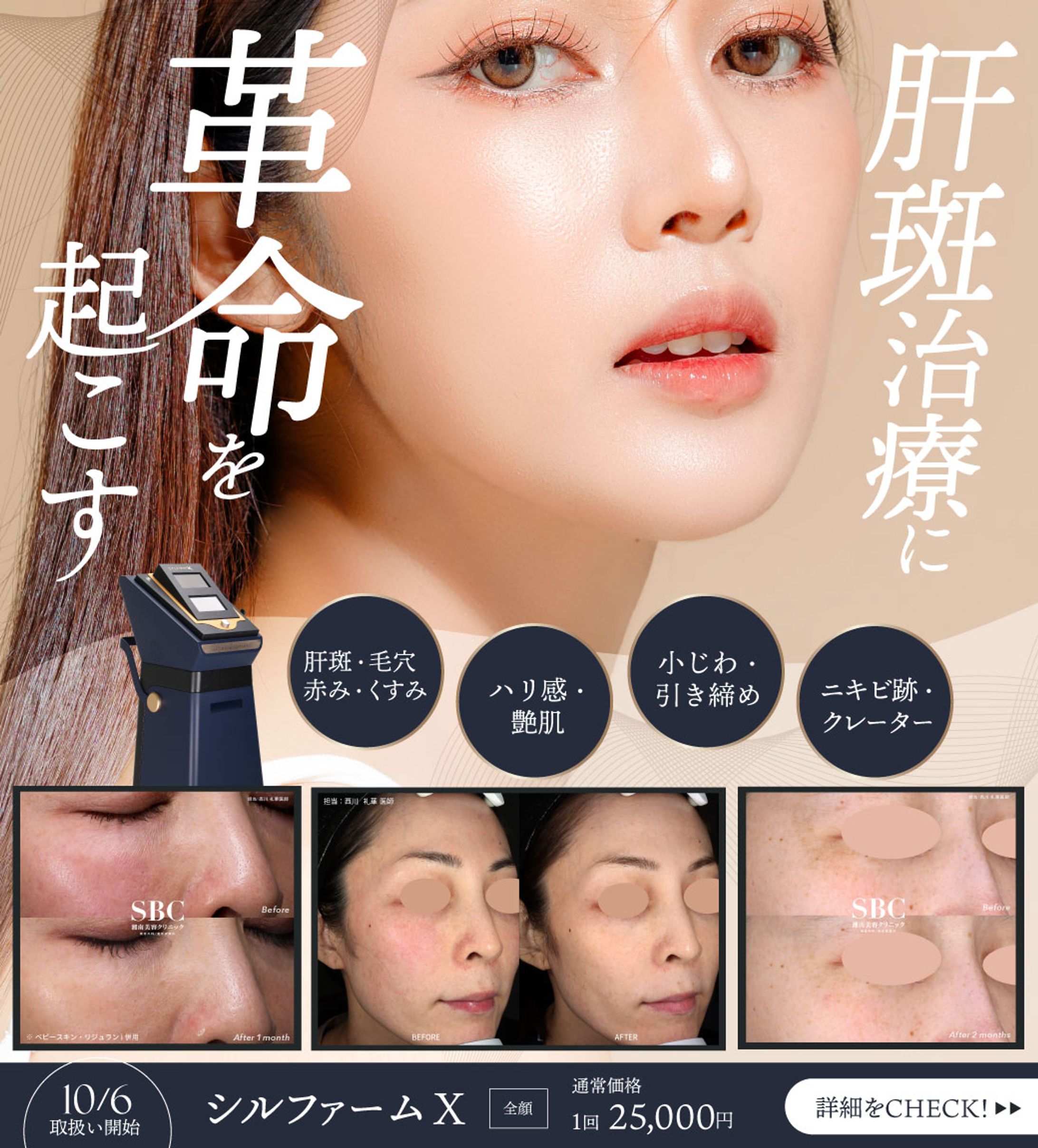 LINE_リッチメッセージ-1