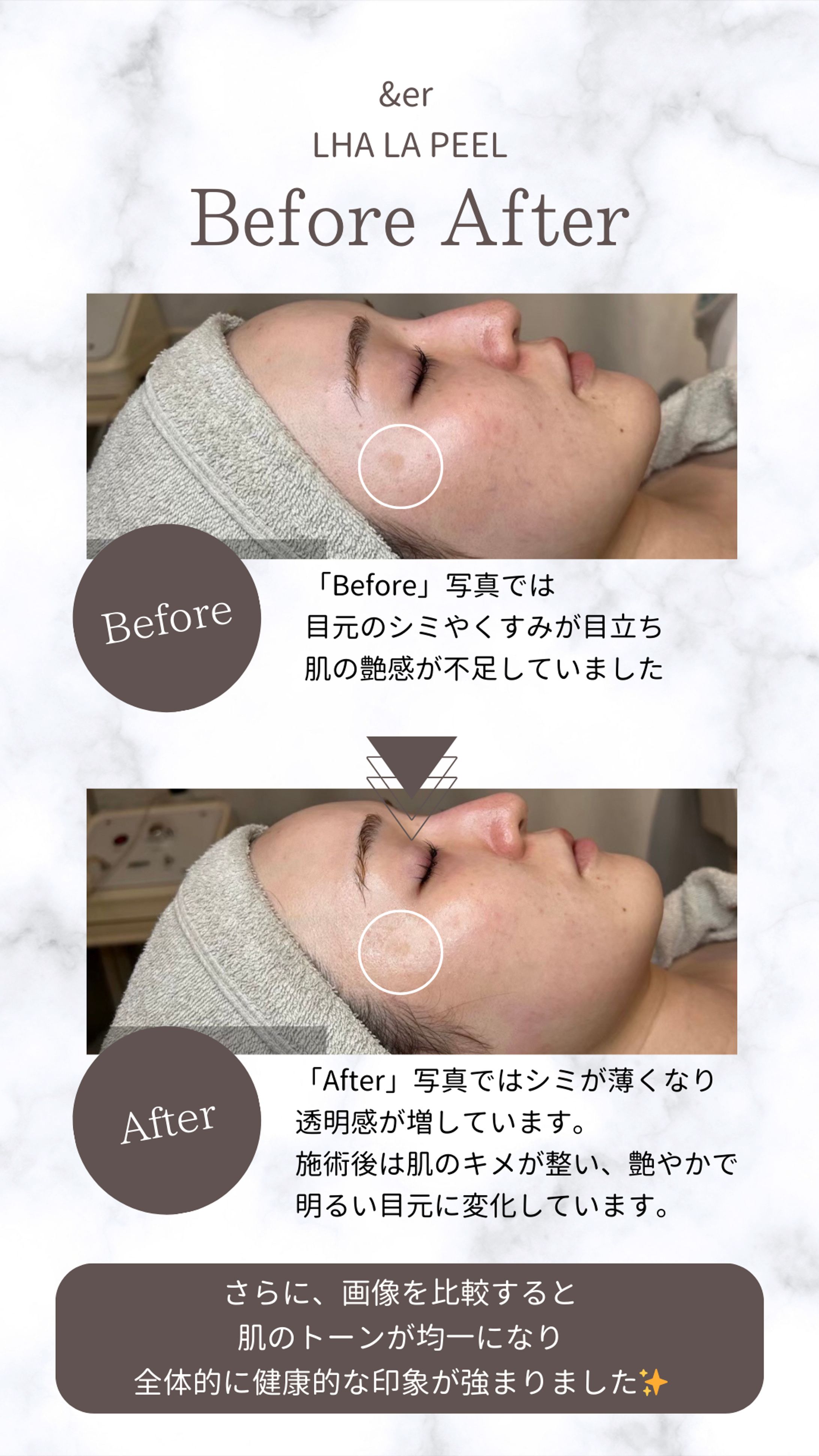 Instagram投稿画像作成(エステサロン)-1