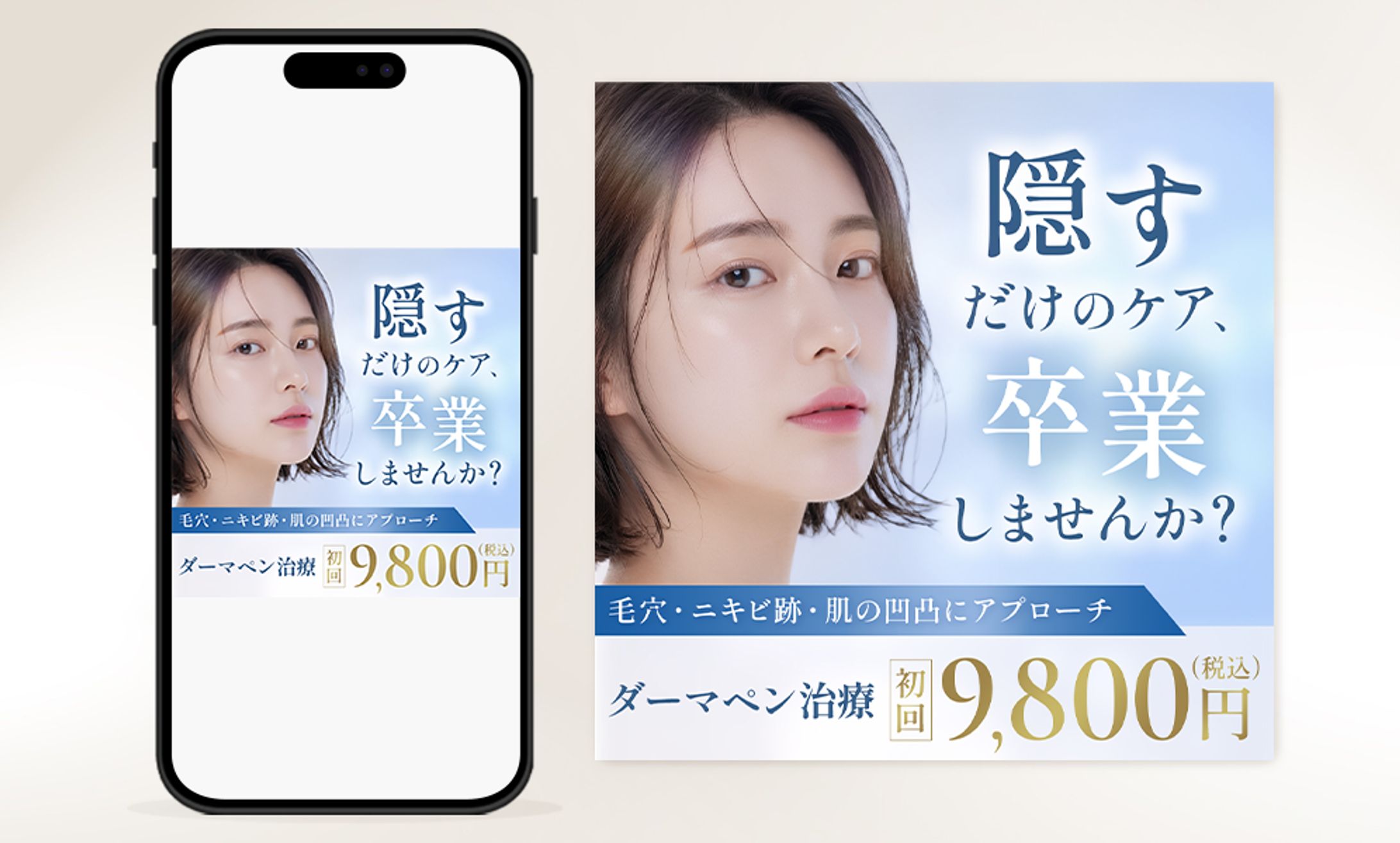 バナー:ダーマペン治療-1