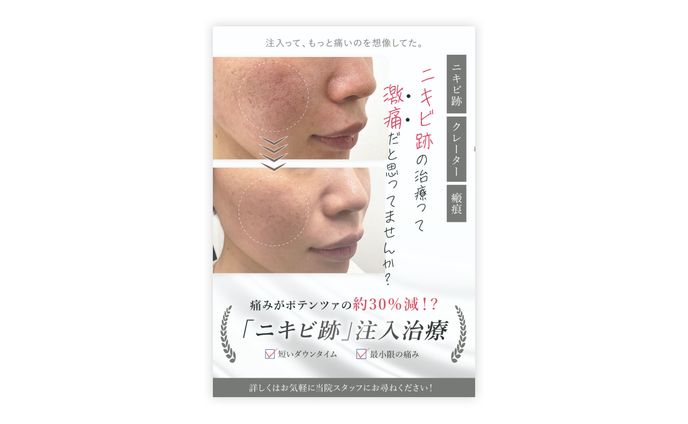 【ポスター】美容クリニック