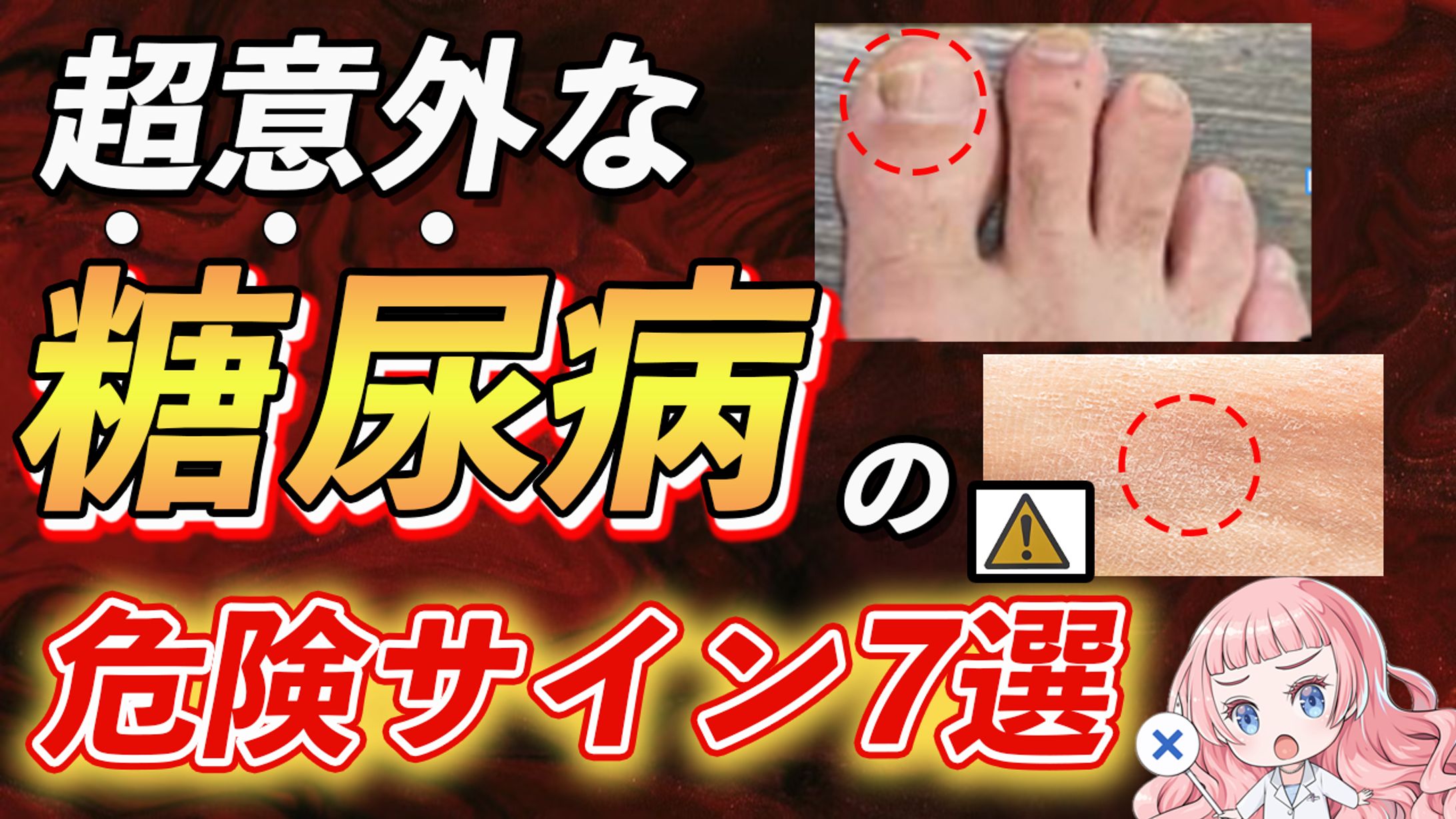 サムネイル４-1