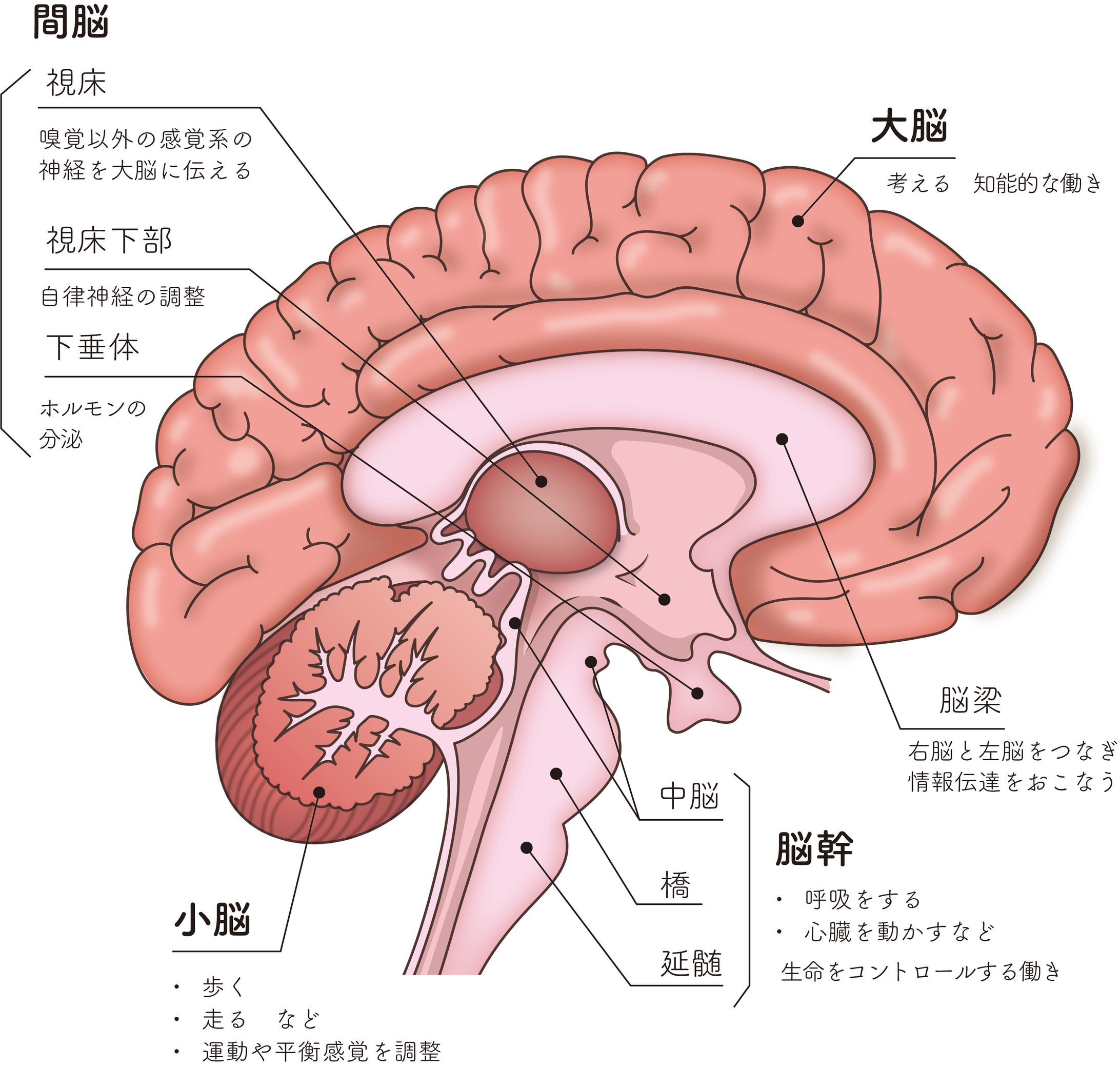 脳-1