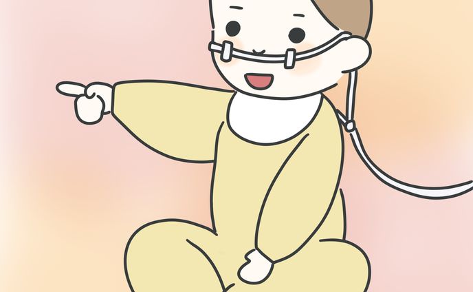医療的ケア児(経管栄養)