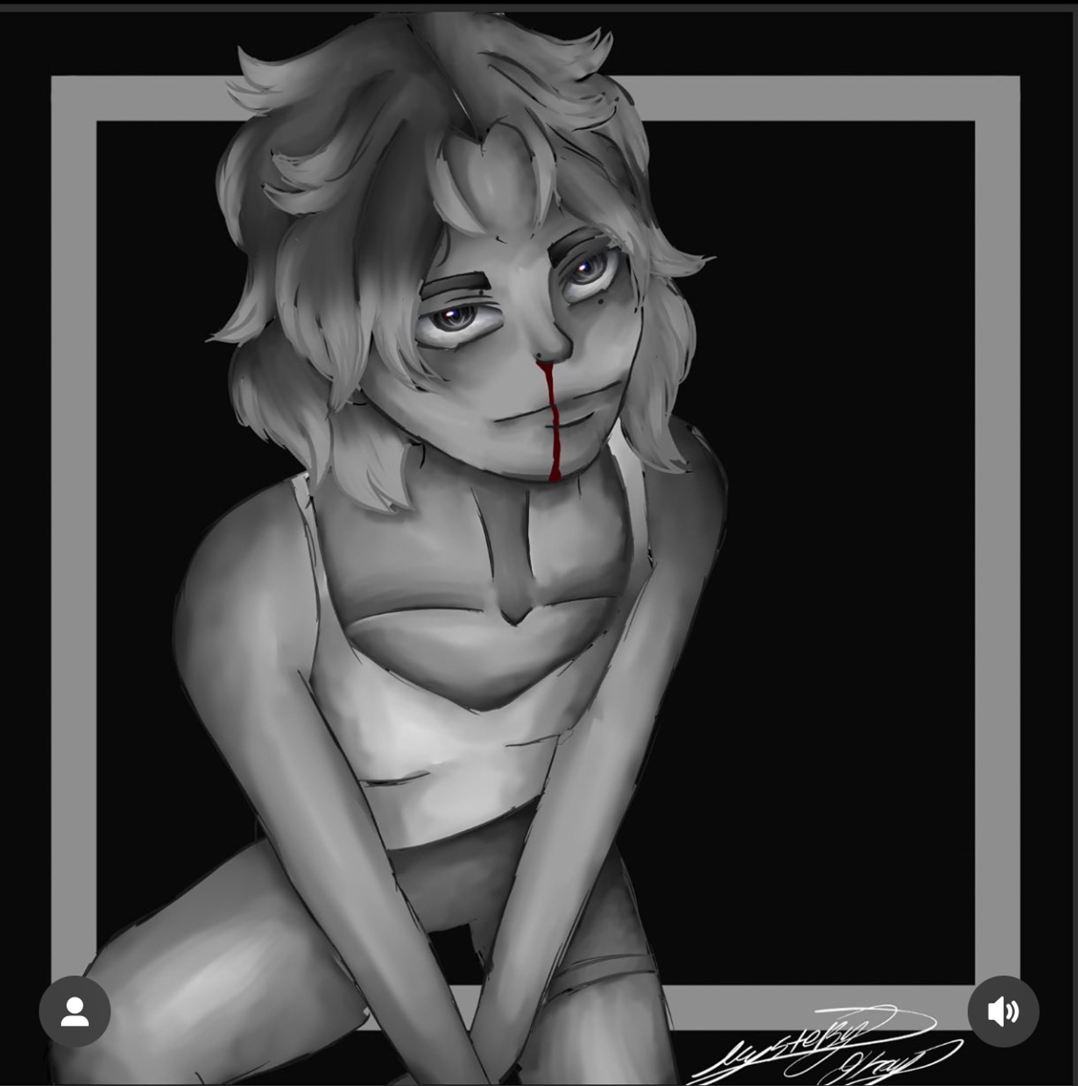 Nose bleeds-1