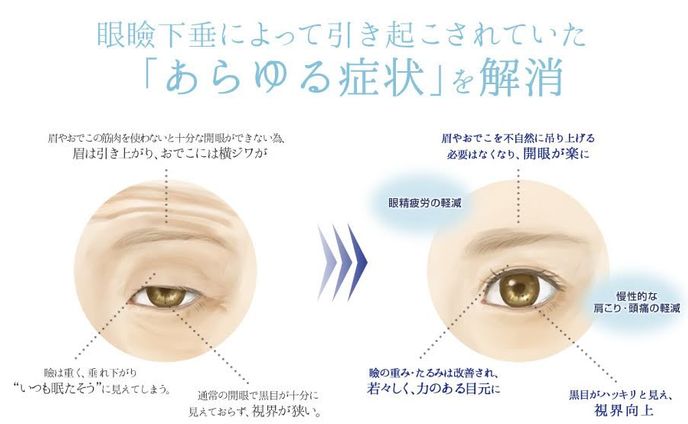 美容クリニックサイト挿絵