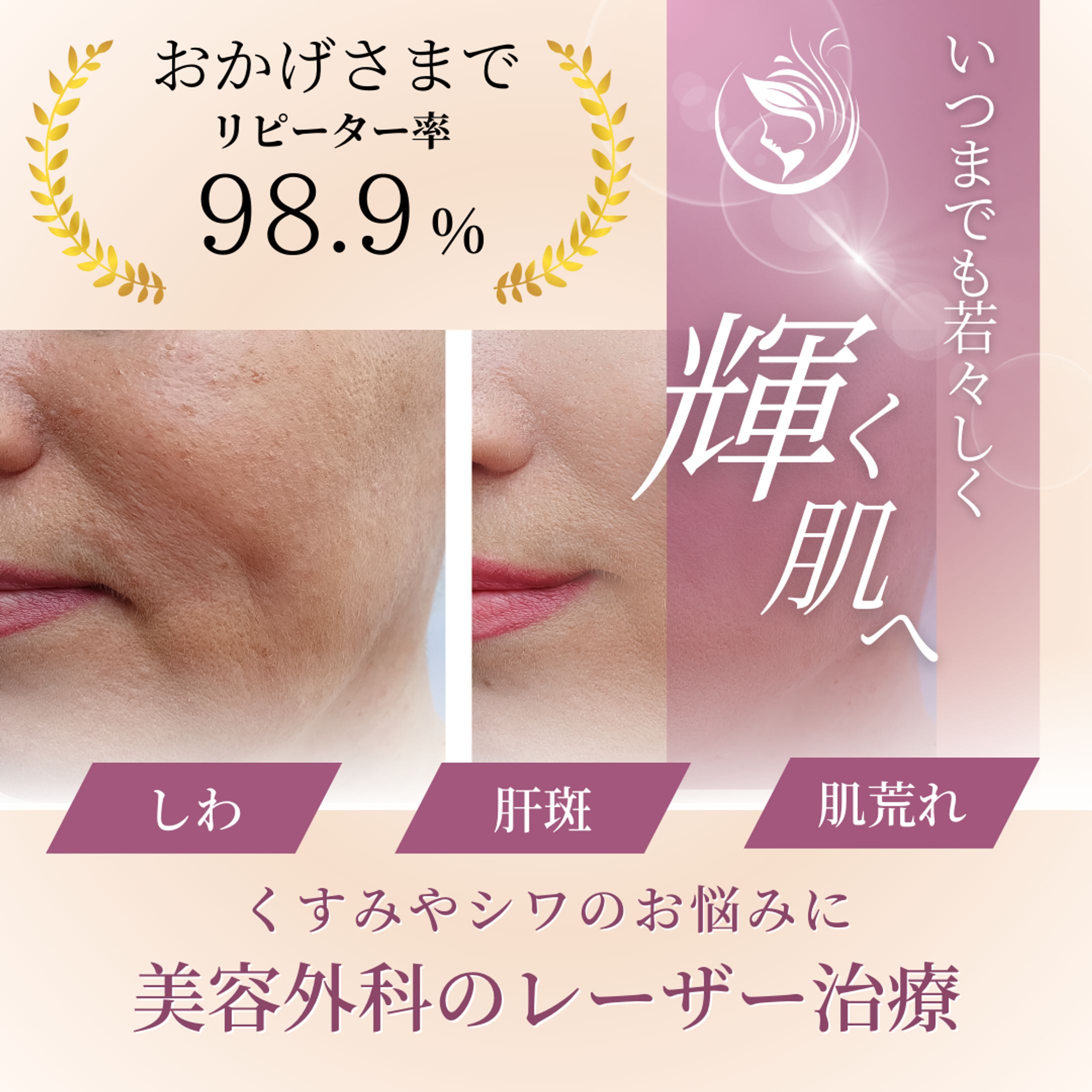 美容系バナー-1