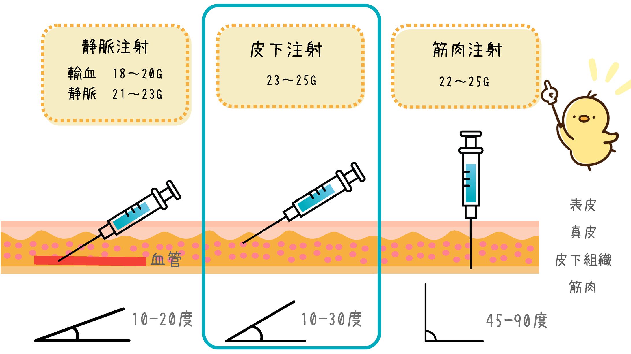 注射　角度-1