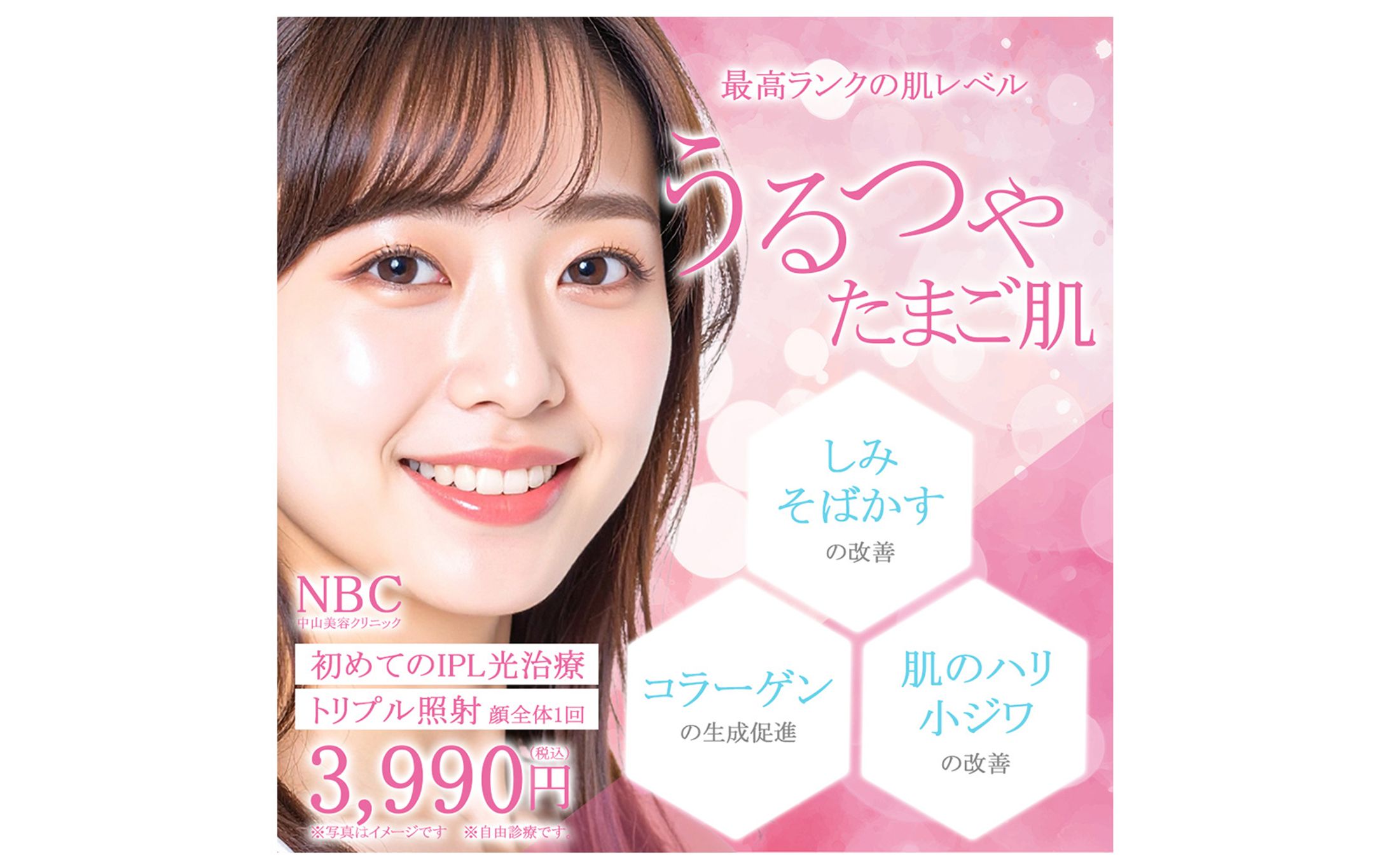 IPL光治療バナー（制作時間：2H）-1