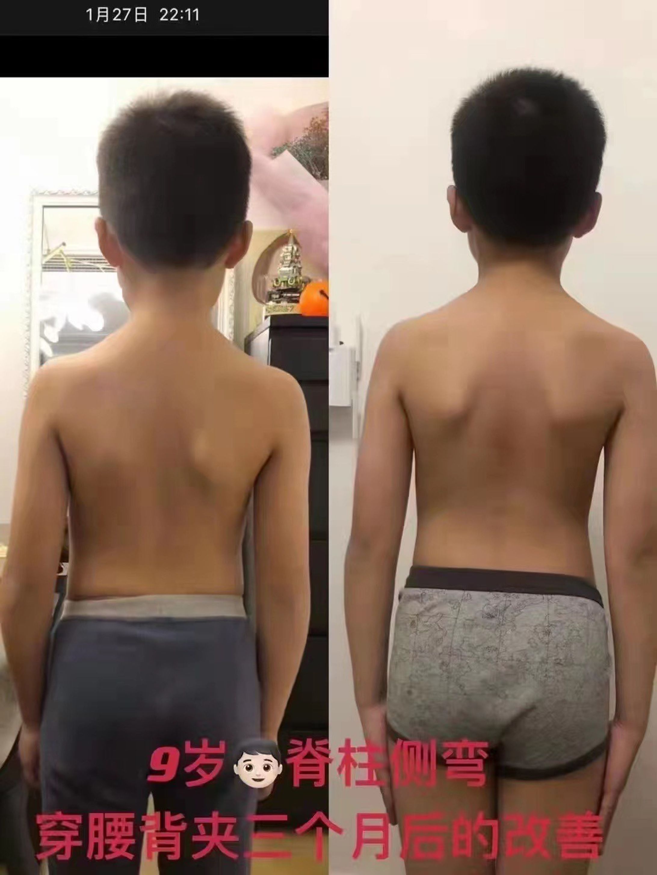 【子ども】劇的ビフォーアフター-1